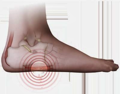 Orthotics & Prosthetics Service «The Good Feet Store», reviews and photos, 3509 Fair Oaks Blvd, Sacramento, CA 95864, USA