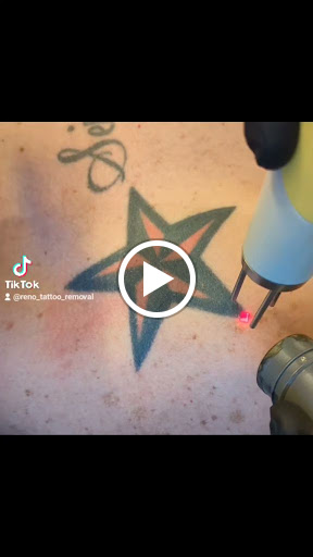 Explore arrow tattoo ideas for men, creative tattoo ideas in Reno, available at Reno Tattoo Removal