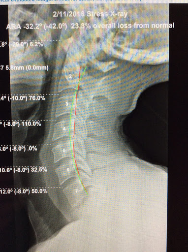 Chiropractor «Complete Health Chiropractic - Littleton», reviews and photos, 791 Southpark Dr #400, Littleton, CO 80120, USA