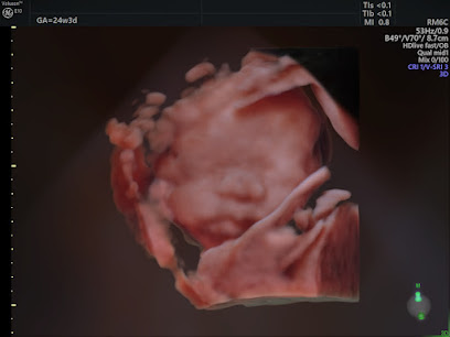 ゆたかマタニティ超音波クリニック 胎児ドック 大阪 遺伝カウンセリング 出生前検査