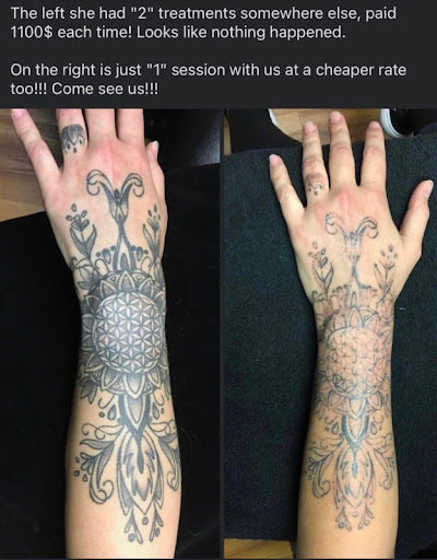 Explore tattoo shading ideas, creative tattoo ideas in Lawton, available at Clean Canvas Tattoo Removal