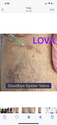 Explore cougar tattoo ideas, creative tattoo ideas in Lake Oswego, available at Lake Oswego Vein and Aesthetic LOVA