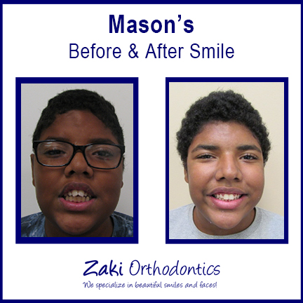 Zaki Orthodontics
