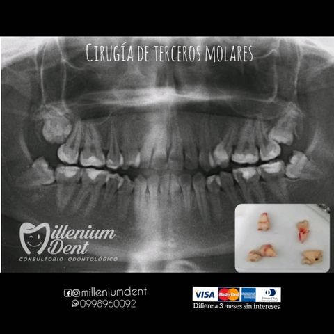 Horarios de Millenium Dent Consultorio Odontológico