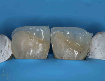 druizclinik prótesis bucal e implantología