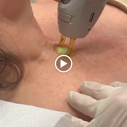 Explore tattoo ideas floral, creative tattoo ideas in Baton Rouge, available at Louisiana Laserderm