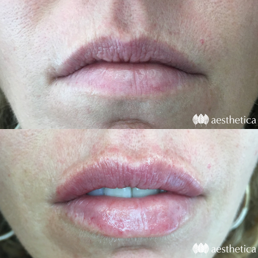 Find cervical cancer tattoos ideas for your next unique tattoo in Pleasant Grove at Aesthetica