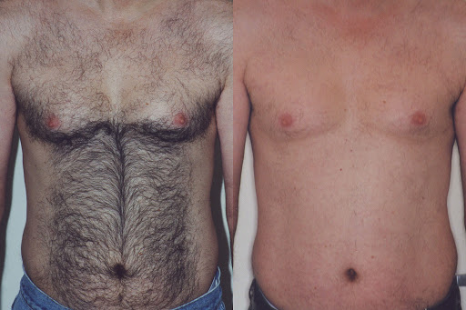 Find scorpion tattoo ideas for your next unique tattoo in Washington at Center For Laser Surgery