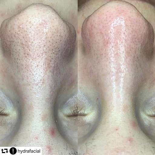 Laser Hair Removal Service «Yana Skin Care», reviews and photos, 3101 Richmond Ave #200, Houston, TX 77098, USA