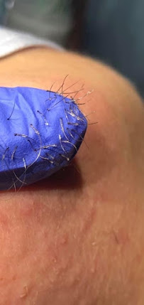 Professional Electrolysis Center - Photo 8 - Car repair in Mandeville, LA, Mandeville