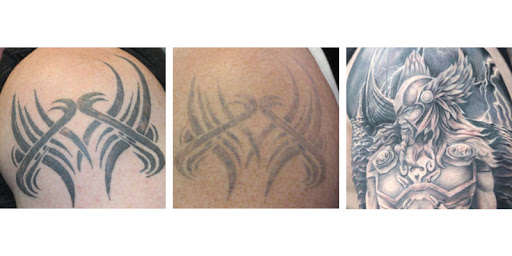 Explore black tattoo cover up ideas, creative tattoo ideas in New York, available at Removery Tattoo Removal & Fading