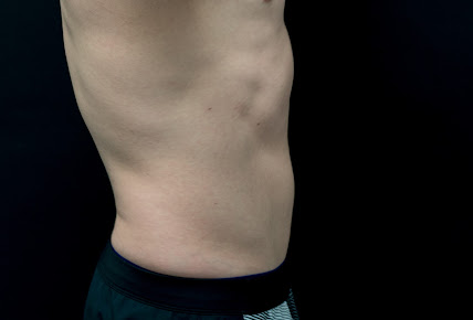 Bucks Cavitation - Bucks Cavitation