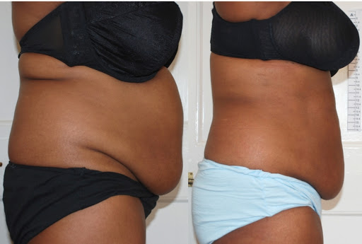 Beauty Salon «Beauty Loft Spa», reviews and photos, 3879 Peachtree Rd NE, Atlanta, GA 30319, USA