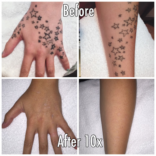 Explore cat paw print tattoo ideas, creative tattoo ideas in Englewood, available at Laser Remedy Skin Solutions