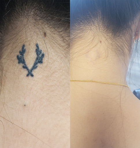 Explore flash sheets tattoo ideas, creative tattoo ideas in Rochester, available at Rochester Tattoo Removal