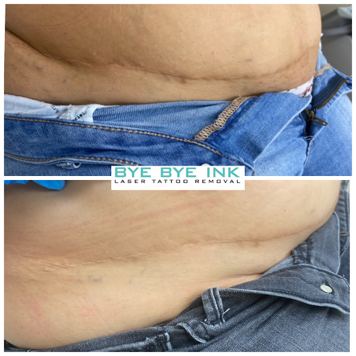 Explore women's arm sleeve tattoo ideas, creative tattoo ideas in Middle Village, available at Bye Bye Ink Laser Tattoo Removal