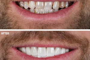 Smile Team Turkey - (Dental Implants, Crowns, Veneers & Teeth Whitening) image
