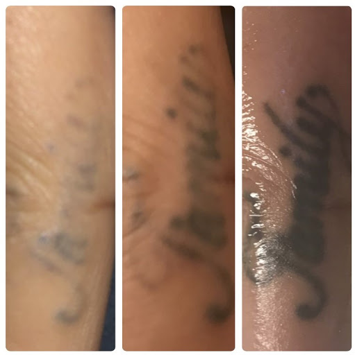Explore tattoo ideas ankle bracelet, creative tattoo ideas in Yuma, available at Yuma Laser Center