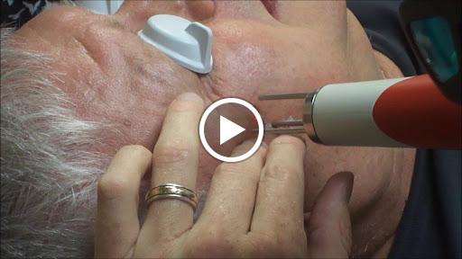 Find robot tattoo ideas for your next unique tattoo in Weatherford at Vanish Laser Tattoo Removal and Skin Aesthetics