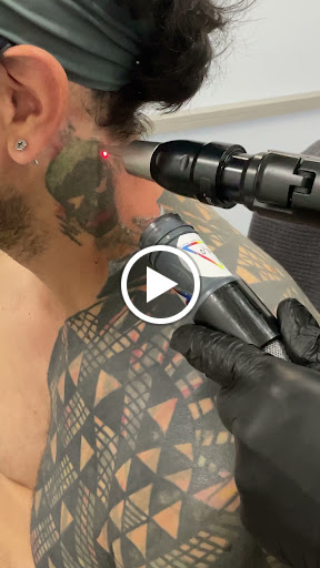 Explore chick tattoo ideas, creative tattoo ideas in New York, available at Ag2g Laser Tattoo Removal & MedSpa