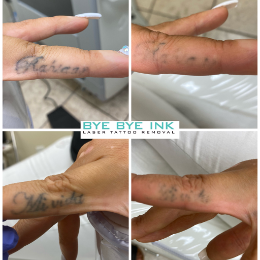 Explore tattoo ideas for children, creative tattoo ideas in Middle Village, available at Bye Bye Ink Laser Tattoo Removal