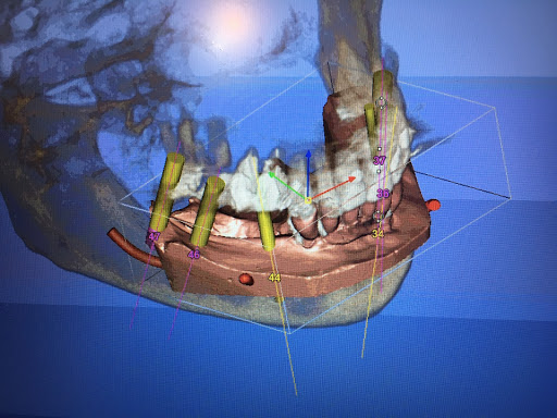 Dental implantology courses Jerusalem