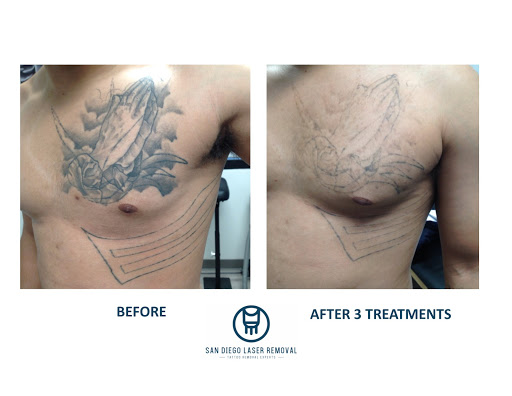 Explore black bear tattoo ideas, creative tattoo ideas in San Diego, available at Removery Tattoo Removal & Fading