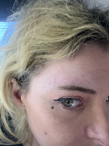 Find simple sun tattoo ideas for your next unique tattoo in Los Angeles at Removery Tattoo Removal & Fading