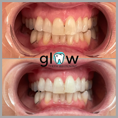Glow Teeth Whitening