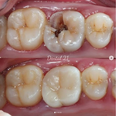 Dental 21 PIK | Spesialis Gigi Rusak, Berlubang & Sakit Gigi