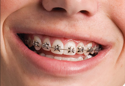 Ortho 360 Orthodontics