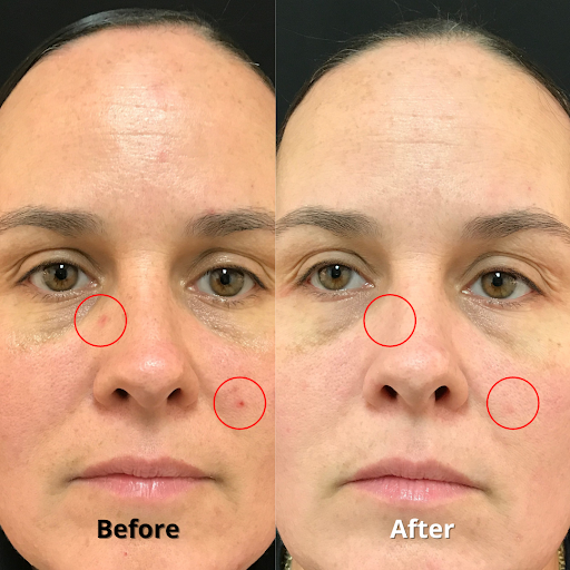 Explore tattoo ideas evil, creative tattoo ideas in Brookfield, available at Milwaukee Laser & Body Aesthetics