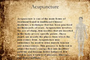 Acupuncture clinic (Dr.Balaje.s) image