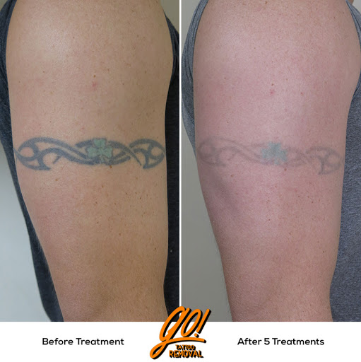 Explore phoenix tattoo ideas male, creative tattoo ideas in Allentown, available at Removery Tattoo Removal & Fading