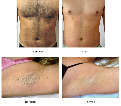 Explore pain tattoo ideas for guys, creative tattoo ideas in Briarcliff Manor, available at Laser Luxury