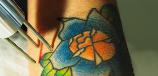 Explore goldendoodle tattoo ideas, creative tattoo ideas in Dallas, available at Astanza Laser