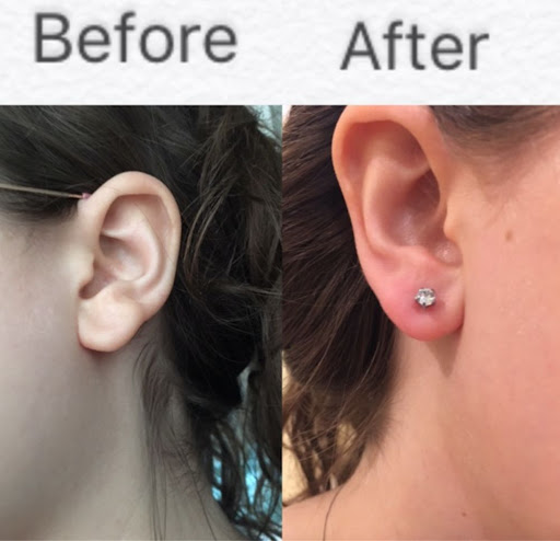 Explore date tattoo idea, creative tattoo ideas in Studio City, available at Dr. Sharon Wollaston Medical Ear Piercing