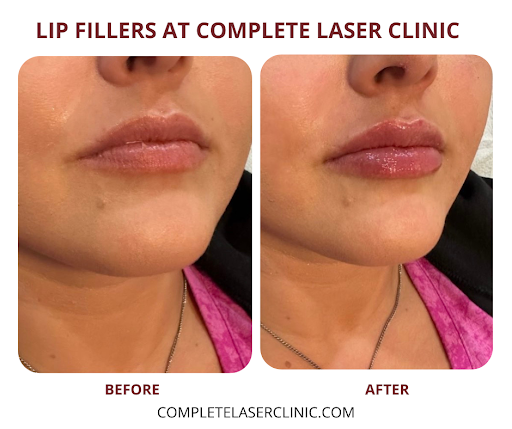 Explore dog nose tattoo ideas, creative tattoo ideas in Mooresville, available at Complete Laser Clinic - Mooresville