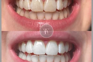 Flawless Whites - Teeth Whitening image