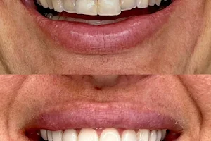 INOA Odontologia | Dentista em Maceió image