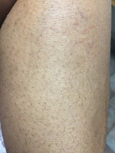 Explore solid tattoo ideas, creative tattoo ideas in Raleigh, available at ExcelLase