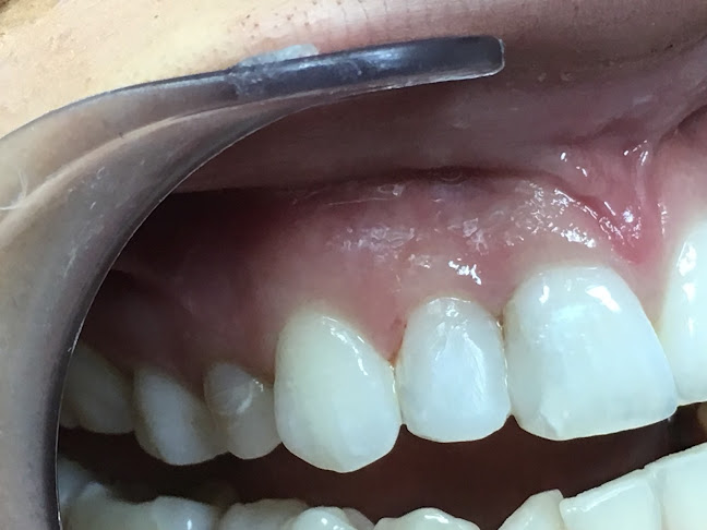 Broj telefona Privatna ordinacija dentalne medicine Ljubomir Erceg