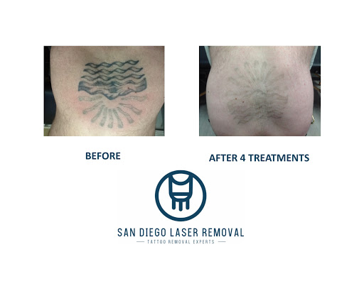 Explore maleficent tattoo ideas, creative tattoo ideas in San Diego, available at Removery Tattoo Removal & Fading