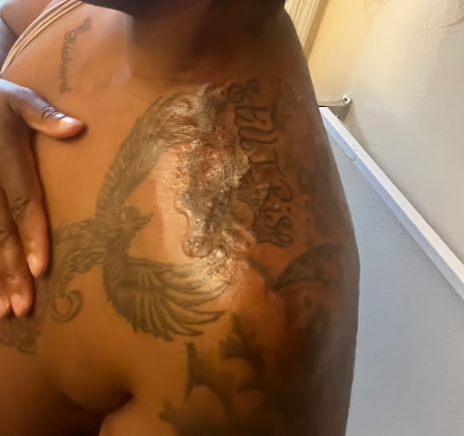 Explore cover up black tattoo ideas, creative tattoo ideas in Jacksonville, available at Renegade Art Studio LLC