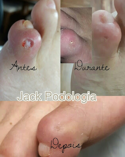 Logo da empresa - Jack Podologia