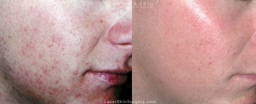 Find mom tattoos ideas for your next unique tattoo in Southampton at Laser & Skin Surgery Center of New York - Southampton