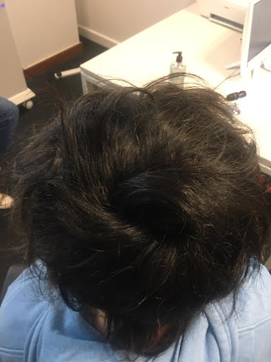 عيادات تساقط الشعر - كارلايل - The Hair Loss Clinics - Carlisle