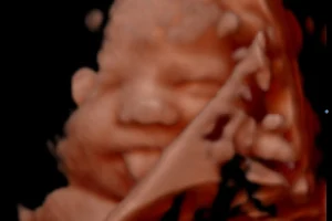 Beautiful Bellies 2D/3D/4D/5D Pregnancy Ultrasound image