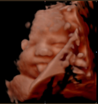 Beautiful Bellies 2D/3D/4D/5D Pregnancy Ultrasound