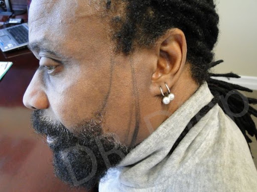 Medical Hair Transplant & Aesthetics image
